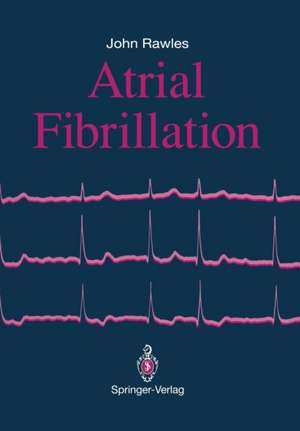 Atrial Fibrillation de John Rawles