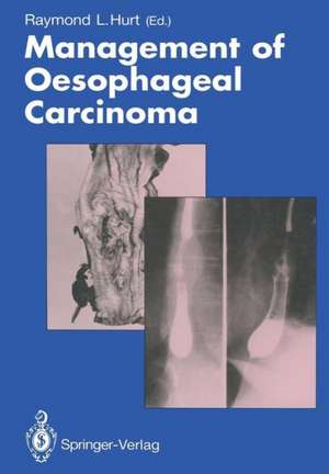 Management of Oesophageal Carcinoma de Raymond L. Hurt