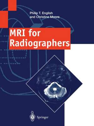 MRI for Radiographers de Philip T. English