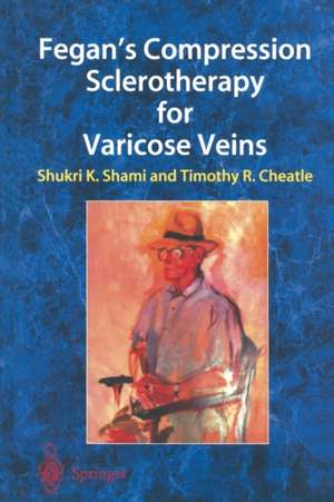 Fegan’s Compression Sclerotherapy for Varicose Veins de Shukri K. Shami