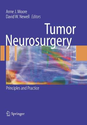 Tumor Neurosurgery: Principles and Practice de Anne J. Moore