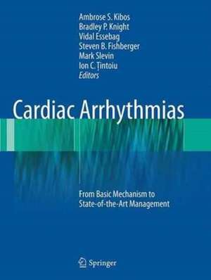 Cardiac Arrhythmias: From Basic Mechanism to State-of-the-Art Management de Ambrose S. Kibos