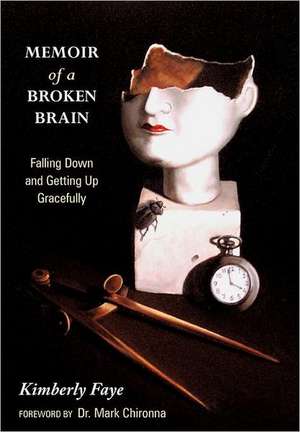 Memoir of a Broken Brain de Kimberly Faye