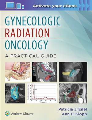 Gynecologic Radiation Oncology: A Practical Guide de Patricia Eifel