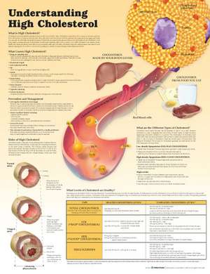 Understanding High Cholesterol Paper de Anatomical Chart Company