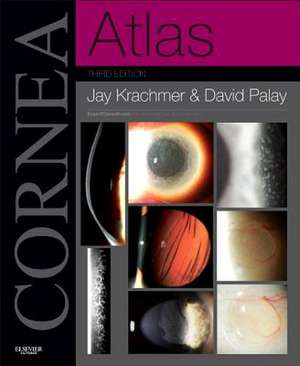 Cornea Atlas: Expert Consult - Online and Print de Jay H. Krachmer