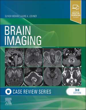 Brain Imaging: Case Review Series de Suyash Mohan