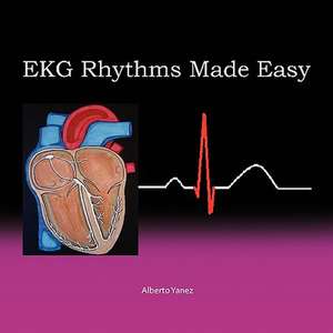 EKG Rhythms Made Easy de Alberto Yanez