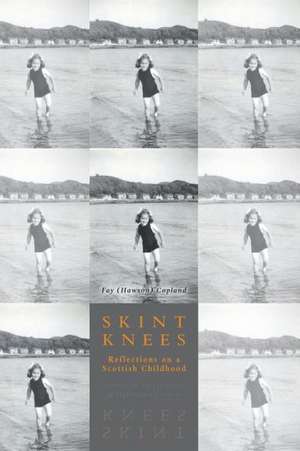 Skint Knees de Fay (Hawson) Copland