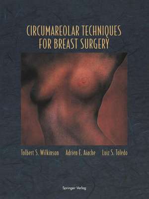 Circumareolar Techniques for Breast Surgery de Tolbert S. Wilkinson