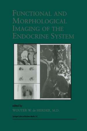 Functional and Morphological Imaging of the Endocrine System de W.W. de Herder