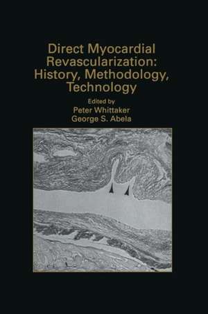 Direct Myocardial Revascularization: History, Methodology, Technology de Peter Whittaker