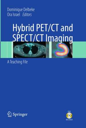 Hybrid PET/CT and SPECT/CT Imaging: A Teaching File de Dominique Delbeke