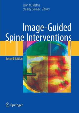 Image-Guided Spine Interventions de John Mathis