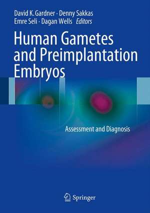 Human Gametes and Preimplantation Embryos: Assessment and Diagnosis de David K. Gardner