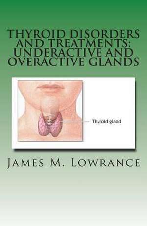 Thyroid Disorders and Treatments de James M. Lowrance