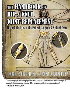 Handbook of Hip & Knee Joint Replacement de Hugate Jr, Dr Ronald R.