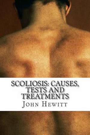 Scoliosis de John Hewitt Ma