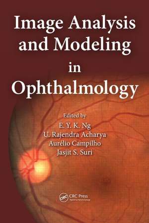 Image Analysis and Modeling in Ophthalmology de Eddie Y. K. Ng