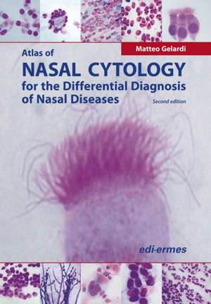 Atlas of Nasal Cytology for the Differential Diagnosis of Nasal Diseases de Matteo Gelardi