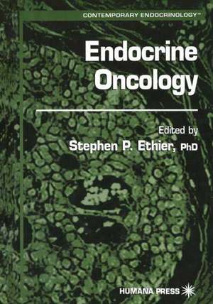 Endocrine Oncology de Stephen P. Ethier