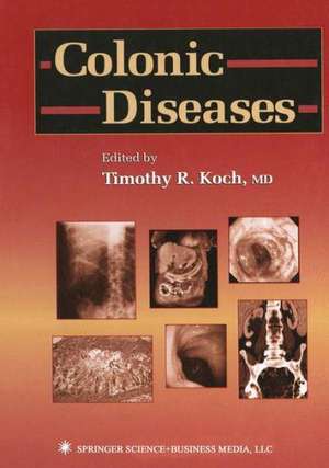 Colonic Diseases de Timothy R. Koch