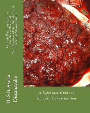 Growth Arameters of the Newborn Revisited with Review of the Standardized Placental Measurements de Dr S. B. Asoka Dissanayake Mbbs