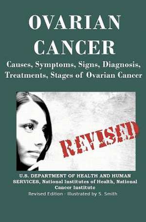 Ovarian Cancer de U. S. Department of Health and Services