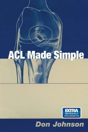 ACL Made Simple de Don Johnson