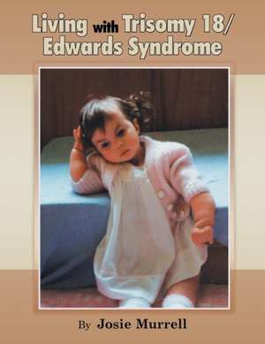 Living with Trisomy 18 / Edwards Syndrome de Josie Murrell