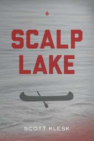 Scalp Lake de Scott Klesk