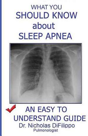 What You Should Know about Sleep Apnea de Difilippo Dr Nicholas