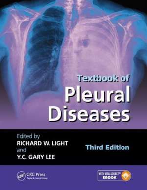 Textbook of Pleural Diseases de Richard W. Light