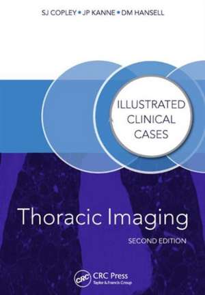 Thoracic Imaging: Illustrated Clinical Cases, Second Edition de Sue Copley