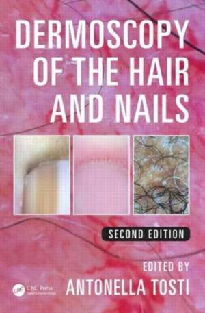 Dermoscopy of the Hair and Nails de Antonella Tosti