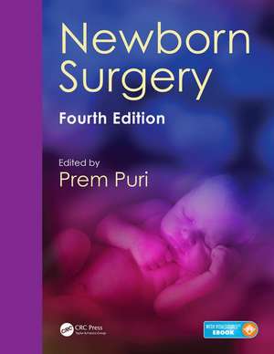 Newborn Surgery de Prem Puri