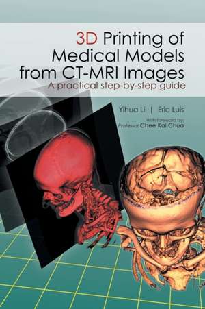 3D Printing of Medical Models from CT-MRI Images de Li Yihua