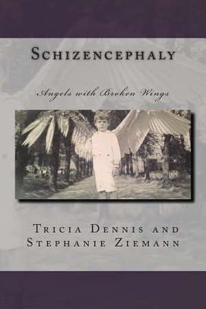 Schizencephaly de Tricia Dennis