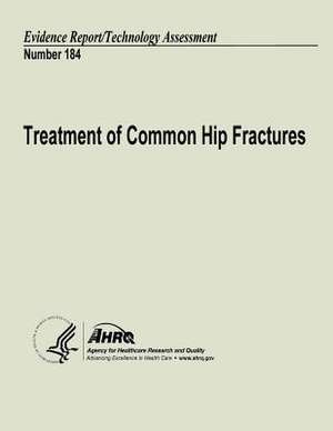 Treatment of Common Hip Fractures de U. S. Department of Heal Human Services