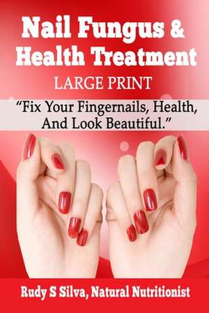 Nail Fungus and Health Treatment de Rudy Silva Silva