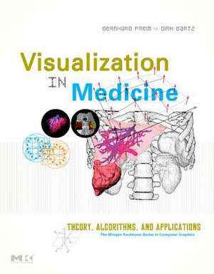 Visual Computing for Medicine: Theory, Algorithms, and Applications de Bernhard Preim