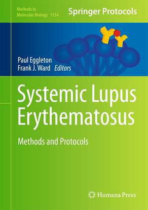 Systemic Lupus Erythematosus: Methods and Protocols de Paul Eggleton