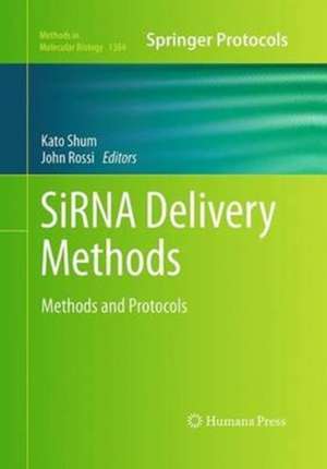 SiRNA Delivery Methods: Methods and Protocols de Kato Shum