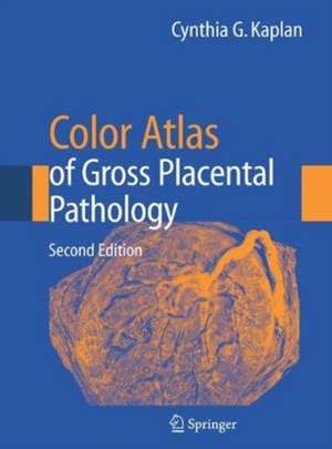 Color Atlas of Gross Placental Pathology de Cynthia G. Kaplan