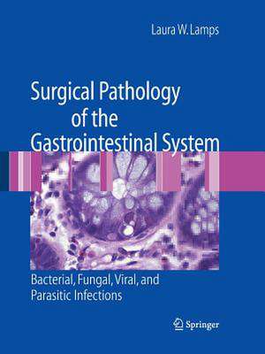 Surgical Pathology of the Gastrointestinal System: Bacterial, Fungal, Viral, and Parasitic Infections de Laura W. Lamps