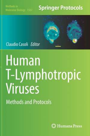 Human T-Lymphotropic Viruses: Methods and Protocols de Claudio Casoli