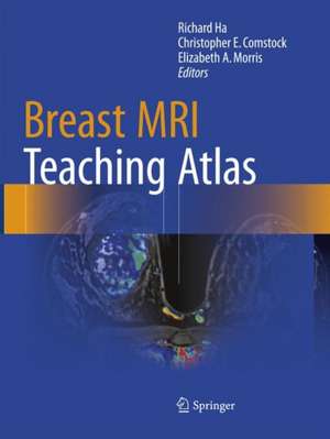 Breast MRI Teaching Atlas de Richard Ha