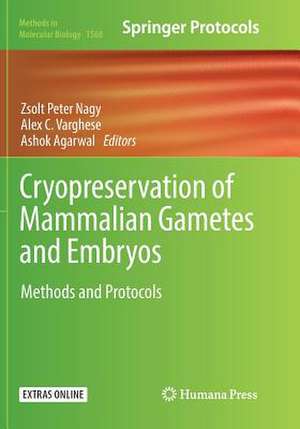 Cryopreservation of Mammalian Gametes and Embryos: Methods and Protocols de Zsolt Peter Nagy