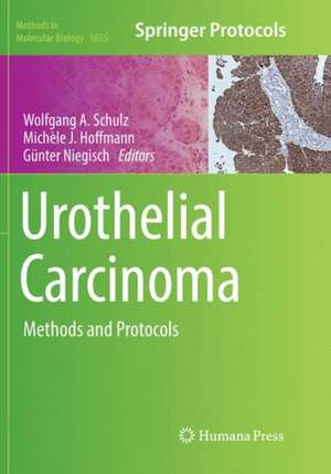 Urothelial Carcinoma: Methods and Protocols de Wolfgang A Schulz