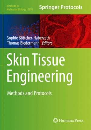 Skin Tissue Engineering: Methods and Protocols de Sophie Böttcher-Haberzeth